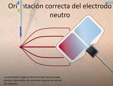 orientación del electrodo neutro